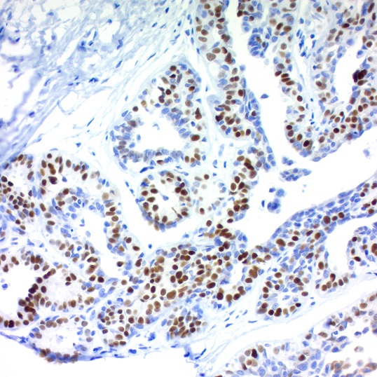 SensiTek HRP Anti-Polyvalent Staining System